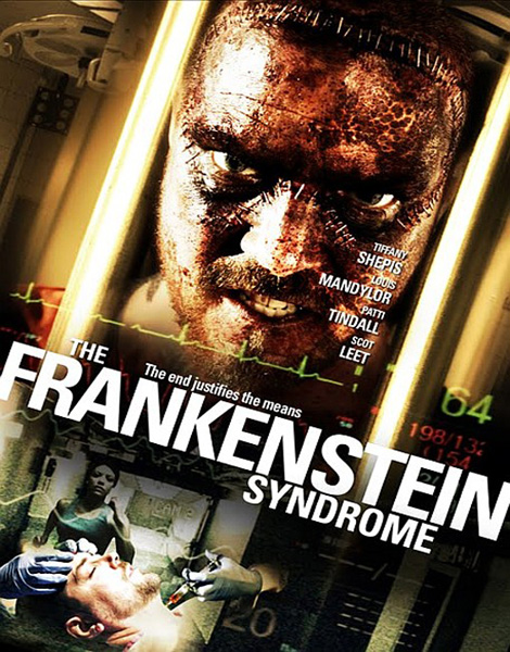 Синдром Франкенштейна / The Frankenstein Syndrome (2010) DVDRip
